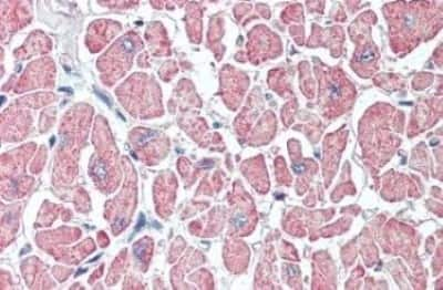 Immunohistochemistry-Paraffin: SLITRK6 Antibody [NBP3-14476] - SLITRK6 antibody IHC of human heart. Immunohistochemistry of formalin-fixed, paraffin-embedded tissue after heat-induced antigen retrieval.